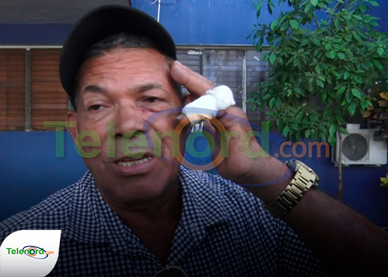 Hombre denuncia que un vecino lo agredió a sillazos en la comunidad el Cigual de SFM