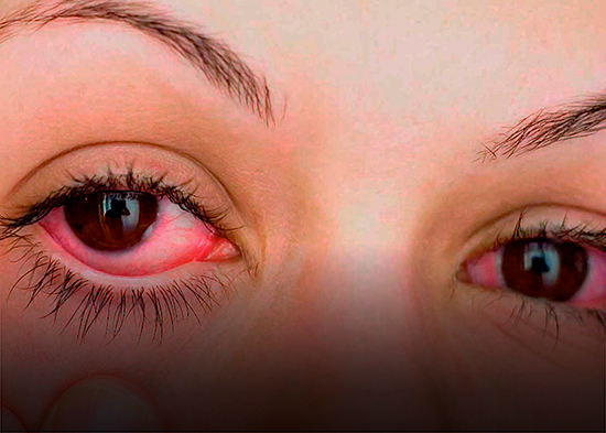 Ojos rojos y picazón: cómo diferenciar entre conjuntivitis y alergia ocular