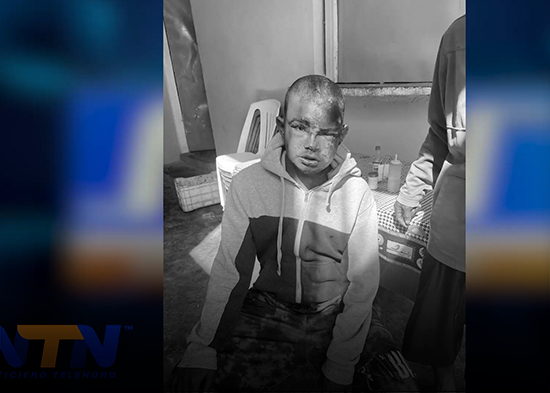 Varios hombres son enviados a prisión por incendiar joven con problemas mentales