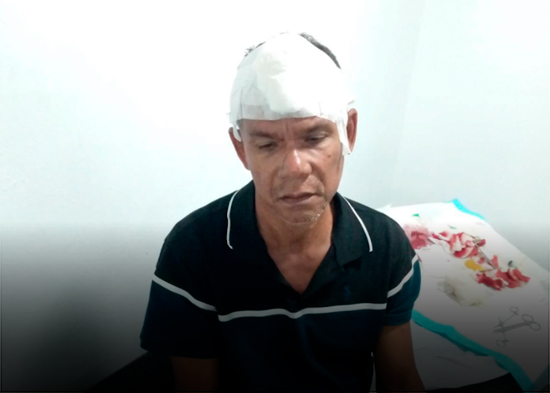 Hombre muere tras presunto enfrentamiento con su hermano en SFM